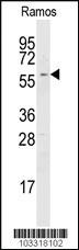 Anti-RYK Mouse Monoclonal Antibody