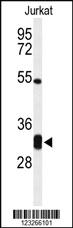 Anti-CPSF4 Rabbit Polyclonal Antibody