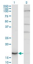 Anti-CYB5A Mouse Monoclonal Antibody [clone: 1A8]