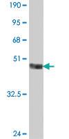 Anti-RPS6KB2 Mouse Polyclonal Antibody