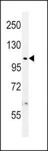 Anti-USP8 Rabbit Polyclonal Antibody (Biotin)