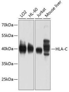 Western blot analysis of extracts of various cell lines, using Anti-HLA-C Antibody (A11247) at 1:1,000 dilution The secondary antibody was Goat Anti-Rabbit IgG H&L Antibody (HRP) at 1:10,000 dilution Lysates/proteins were present at 25 µg per lane