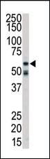 Anti-RYK Mouse Monoclonal Antibody