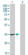 Anti-NAB2 Mouse Polyclonal Antibody