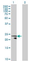 Anti-SOD2 Mouse Polyclonal Antibody