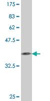 Anti-CD93 Mouse Monoclonal Antibody [clone: 1A4]