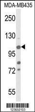 Anti-KDM4B Rabbit Polyclonal Antibody (HRP (Horseradish Peroxidase))