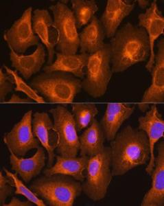 Immunofluorescence analysis of U2OS cells using Anti-HLA-C Antibody (A11247) at a dilution of 1:100 DAPI was used to stain the cell nuclei (blue)