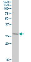 Anti-SOD2 Mouse Polyclonal Antibody