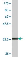 Anti-CCL18 Mouse Monoclonal Antibody [clone: 2C6]