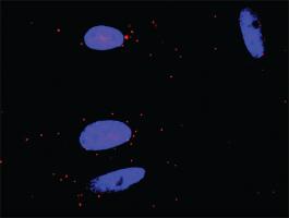 Anti-GRAP2 + CSF1R Antibody Pair