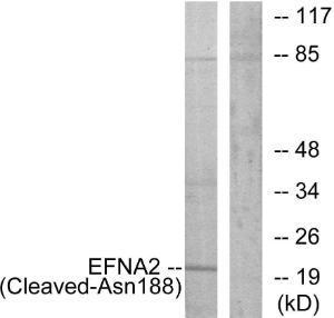 Anti-Ephrin A2 Rabbit Polyclonal Antibody