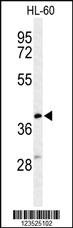 Anti-MT-CYB Rabbit Polyclonal Antibody