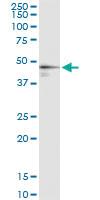 Anti-FDPS Polyclonal Antibody Pair