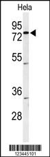 Anti-CLPTM1 Rabbit Polyclonal Antibody