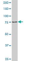 Anti-TGM2 Rabbit Polyclonal Antibody