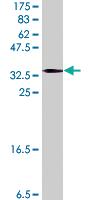 Anti-CYP24A1 Mouse Polyclonal Antibody