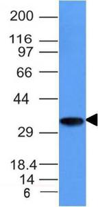 Western blot analysis of Raji cell lysate using Anti-CD74 Antibody [CLIP/1133]