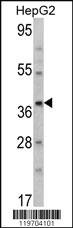 Anti-AMT Rabbit Polyclonal Antibody