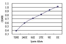 Anti-RPS6KB2 Antibody Pair