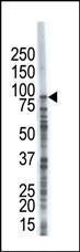 Anti-USP8 Rabbit Polyclonal Antibody (APC (Allophycocyanin))