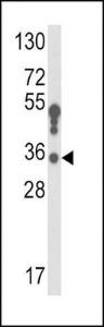 Anti-HSD17B3 Rabbit Polyclonal Antibody (Biotin)