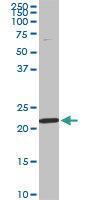 Anti-RPS7 Mouse Monoclonal Antibody [clone: 3G4]