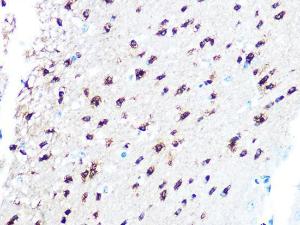 Immunohistochemistry analysis of paraffin-embedded mouse brain using Anti-TPPP Antibody [ARC1129] (A305920) at a dilution of 1:100 (40x lens). Perform microwave antigen retrieval with 10 mM PBS buffer pH 7.2 before commencing with IHC staining protocol