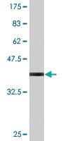 Anti-AKAP7 Mouse Monoclonal Antibody [clone: 1F9]