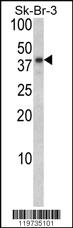 Anti-BGN Rabbit Polyclonal Antibody