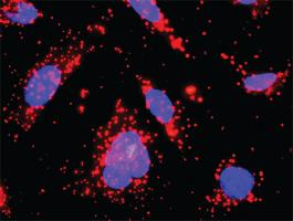 Anti-KIT + CSF2RA Antibody Pair