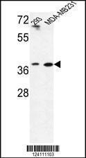 Anti-MAT2B Rabbit Polyclonal Antibody (Biotin)