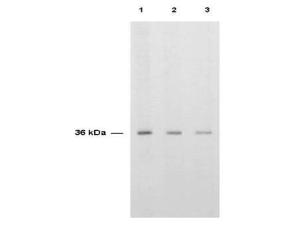 Anti-thymidylate SYN 0.1 ml