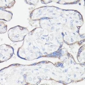 Immunohistochemistry analysis of paraffin-embedded human placenta using Anti-CLUH Antibody (A11250) at a dilution of 1:100 (40X lens). Perform microwave antigen retrieval with 10 mM PBS buffer pH 7.2 before commencing with IHC staining protocol