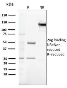 Antibody anti-GASTRIN GAST2632 100 µg