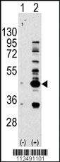 Anti-ANKRD34C Rabbit Polyclonal Antibody