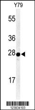 Anti-AANAT Rabbit Polyclonal Antibody