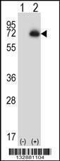 Anti-CPN2 Rabbit Polyclonal Antibody