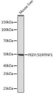 Anti-PEDF Rabbit Monoclonal Antibody [clone: ARC0784]