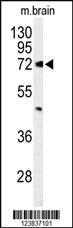 Anti-ABCD2 Rabbit Polyclonal Antibody