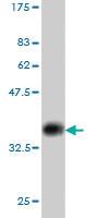 Anti-RFWD2 Mouse Monoclonal Antibody [clone: 1E4]