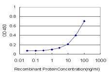 Anti-RPS7 Mouse Monoclonal Antibody [clone: 3G4]