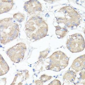 Immunohistochemistry analysis of paraffin-embedded human stomach using Anti-CLUH Antibody (A11250) at a dilution of 1:100 (40X lens). Perform microwave antigen retrieval with 10 mM PBS buffer pH 7.2 before commencing with IHC staining protocol