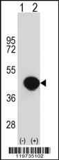 Anti-BGN Rabbit Polyclonal Antibody