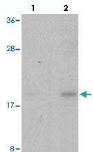 Anti-SPATA4 Rabbit Polyclonal Antibody