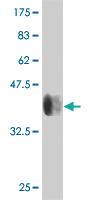 Anti-RPS6KB2 Mouse Monoclonal Antibody [clone: 4B11]