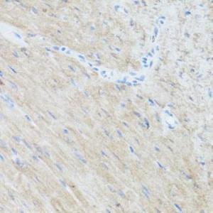 Immunohistochemistry analysis of paraffin-embedded mouse heart using Anti-CLUH Antibody (A11250) at a dilution of 1:100 (40X lens). Perform microwave antigen retrieval with 10 mM PBS buffer pH 7.2 before commencing with IHC staining protocol