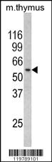 Anti-BLNK Rabbit Polyclonal Antibody