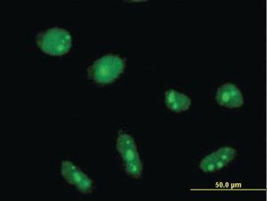 Anti-CYLD Mouse Monoclonal Antibody [clone: 3A9]