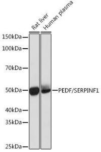 Anti-PEDF Rabbit Monoclonal Antibody [clone: ARC0784]